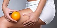 домашнее лечение целлюлита